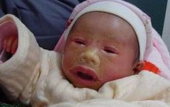 三代试管单囊胚成功率高吗？三代试管婴儿囊胚移植成功率