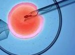 2026年试管婴儿技术与胚胎冷冻指南