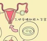 青岛试管婴儿医院排名哪家好？